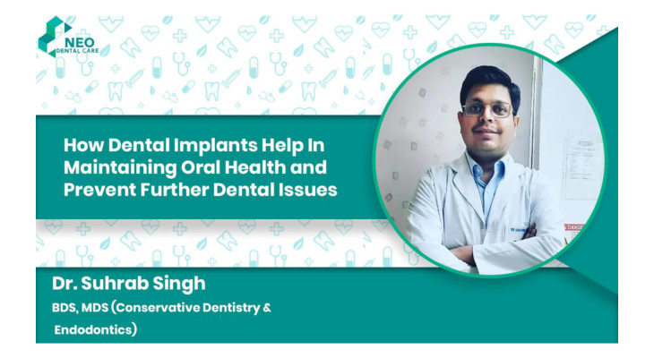 How Dental Implants Help in Maintaining Oral Health and Prevent Further Dental Issues