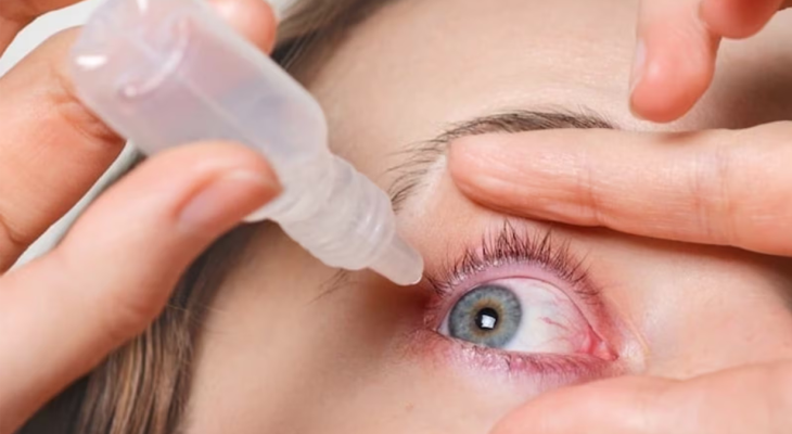 Conjunctivitis Virus: All you need to know about the Pink eye spread